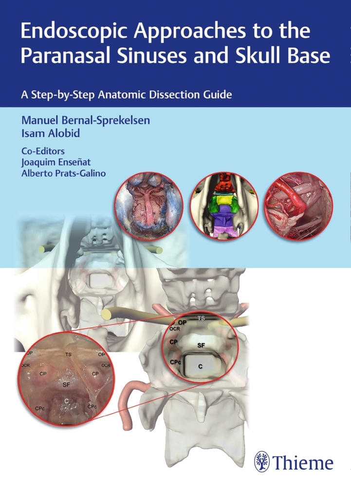 Endoscopic Approaches to the Paranasal Sinuses and Skull Base main product photo