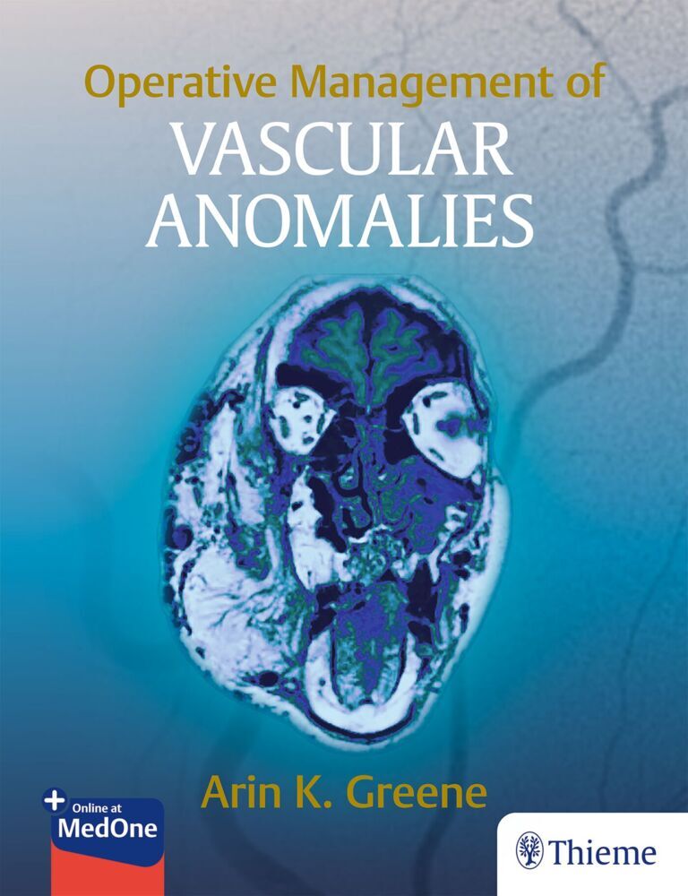 Operative Management of Vascular Anomalies main product photo