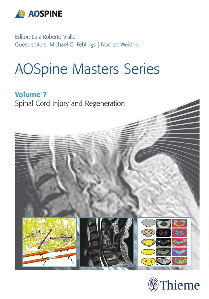 AOSpine Masters Series - Spinal Cord Injury and Regeneration main product photo