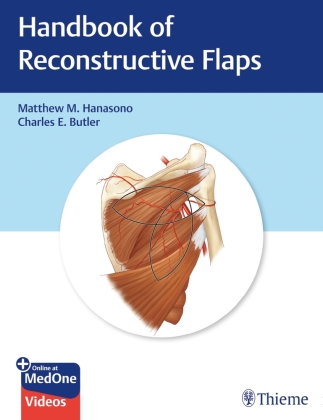 Handbook of Reconstructive Flaps