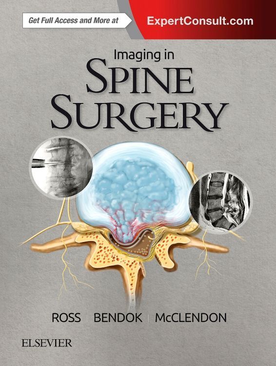 Imaging in Spine Surgery main product photo