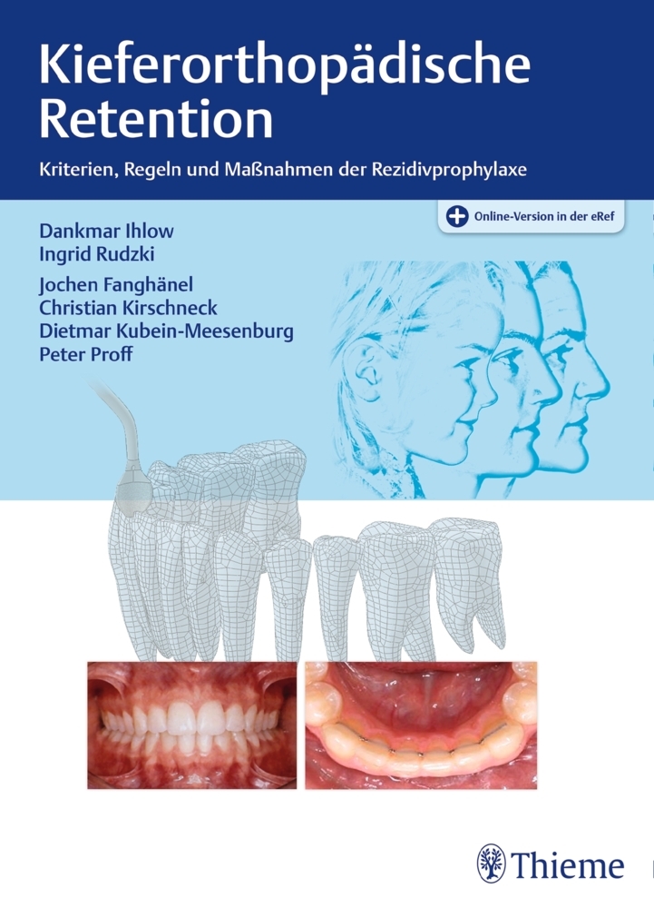 Kieferorthopädische Retention main product photo