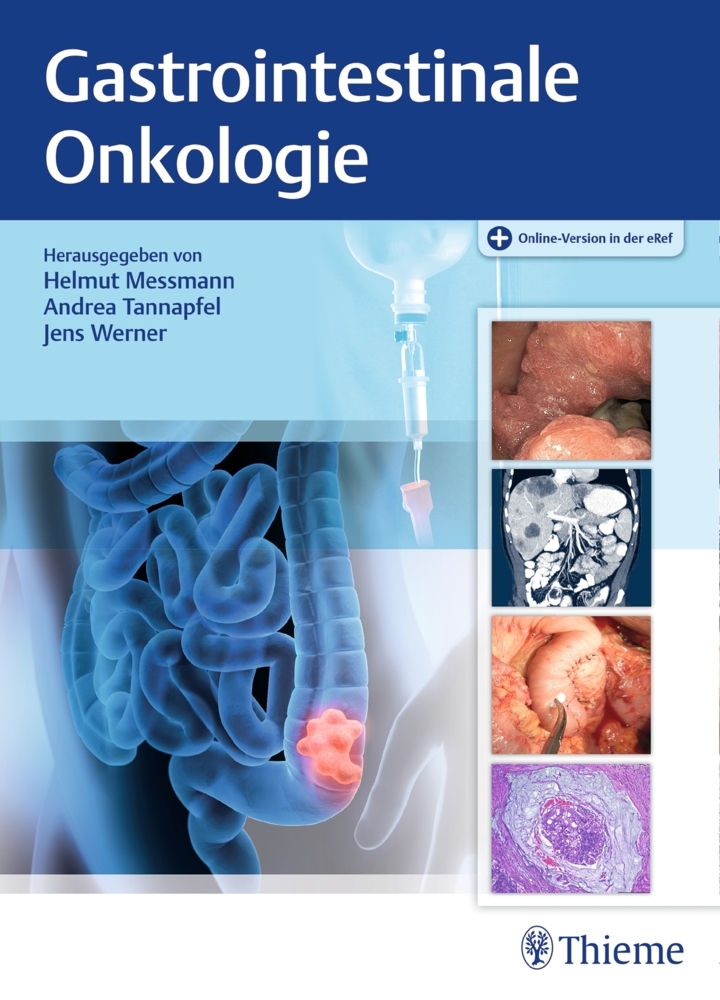 Gastrointestinale Onkologie main product photo