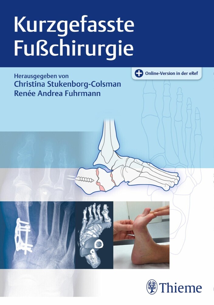 Kurzgefasste Fußchirurgie main product photo