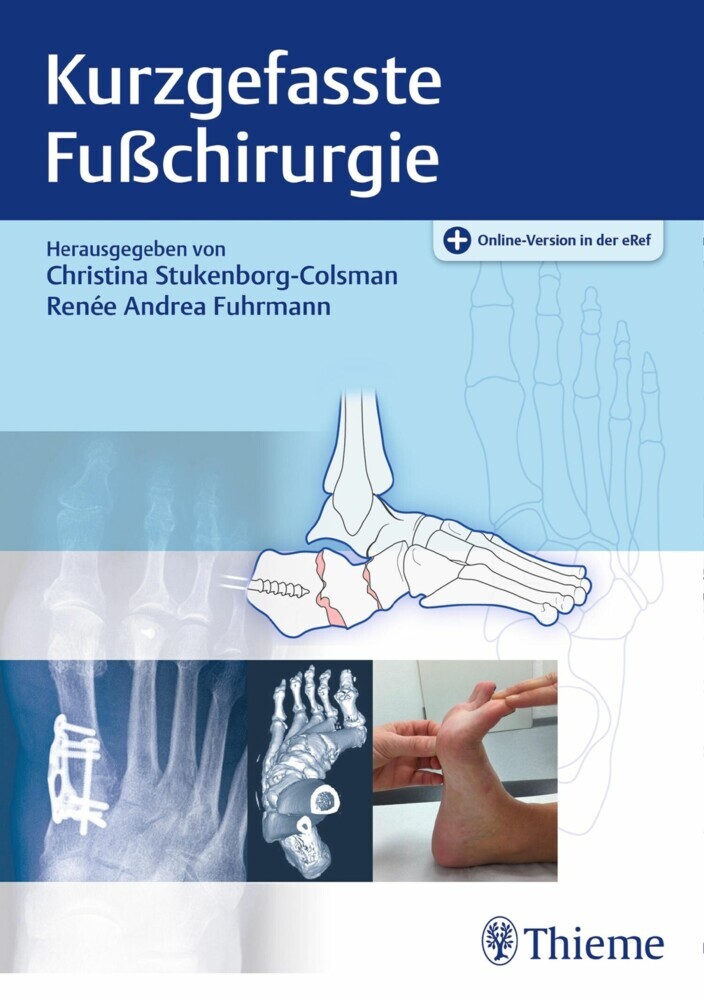 Kurzgefasste Fußchirurgie main product photo