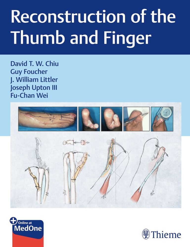Reconstruction of the Thumb and Finger main product photo