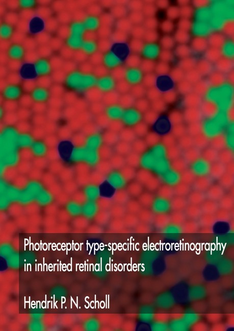 Photoreceptor type-specific electroretinography in inherited retinal disorders main product photo