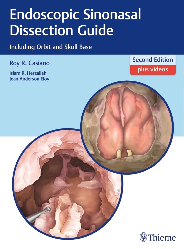 Endoscopic Sinonasal Dissection Guide main product photo