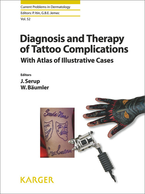 Diagnosis and Therapy of Tattoo Complications main product photo