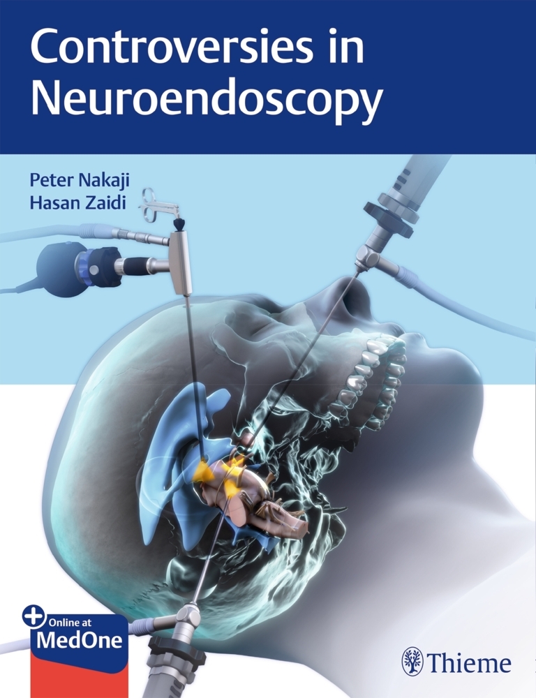 Controversies in Neuroendoscopy main product photo