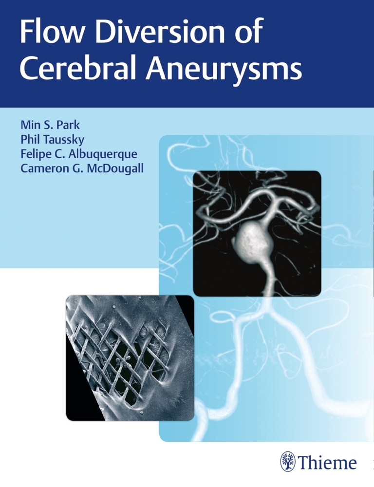 Flow Diversion of Cerebral Aneurysms main product photo