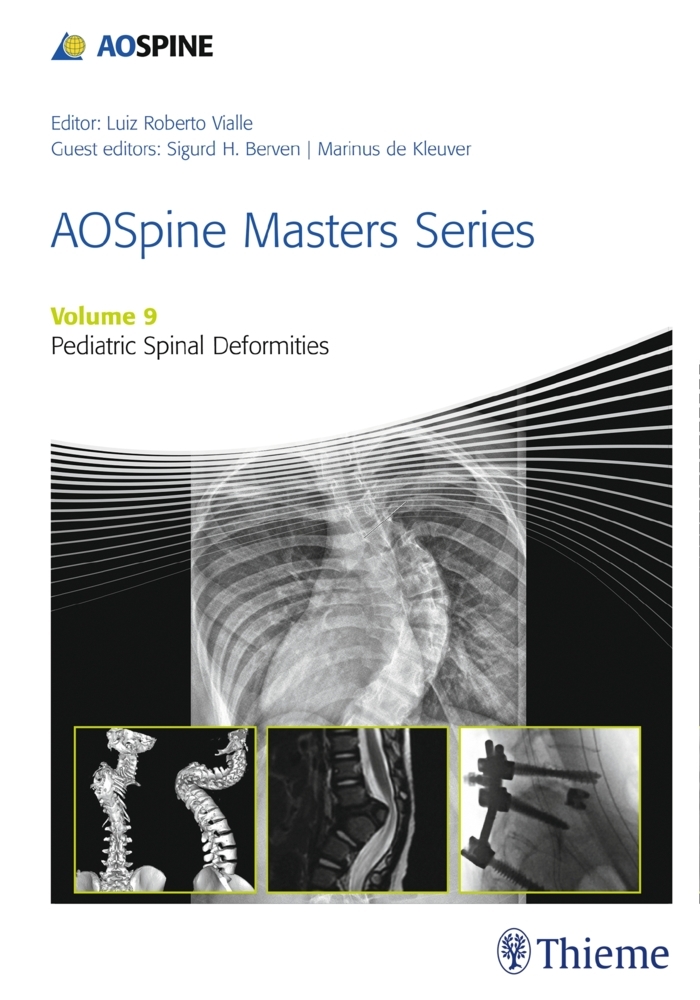 AOSpine Masters Series, Volume 9: Pediatric Spinal Deformities main product photo