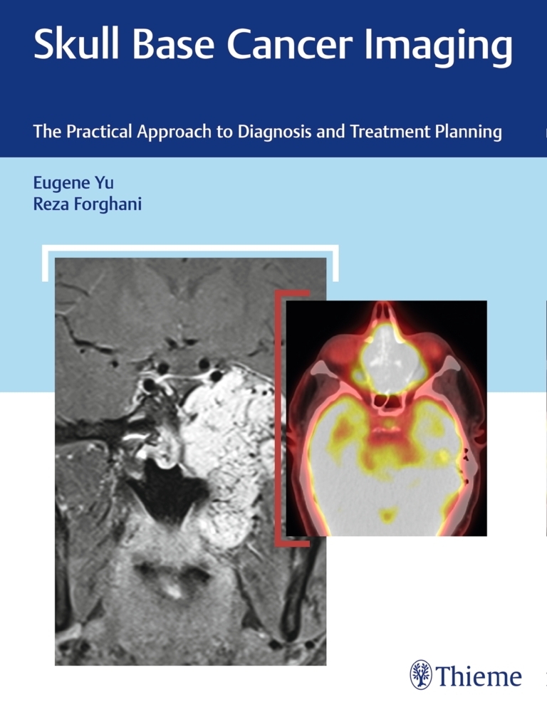 Skull Base Cancer Imaging main product photo