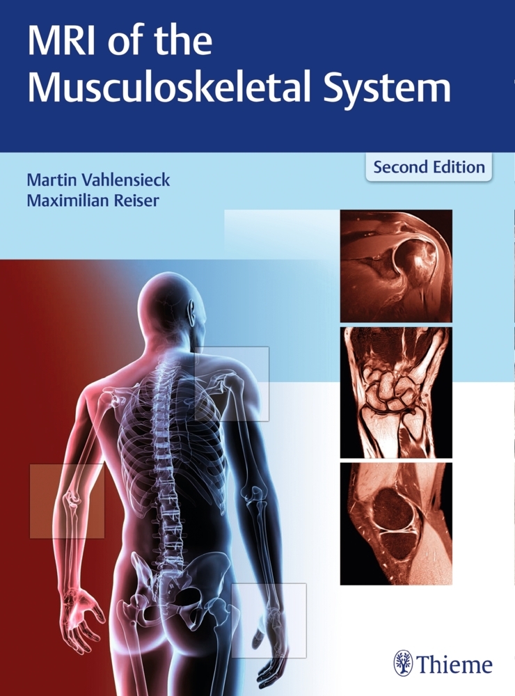 MRI of the Musculoskeletal System main product photo