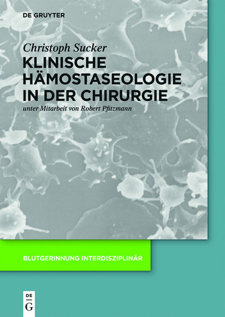 Klinische Hämostaseologie in der Chirurgie main product photo