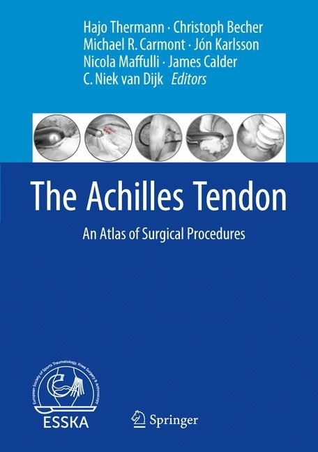 The Achilles Tendon main product photo