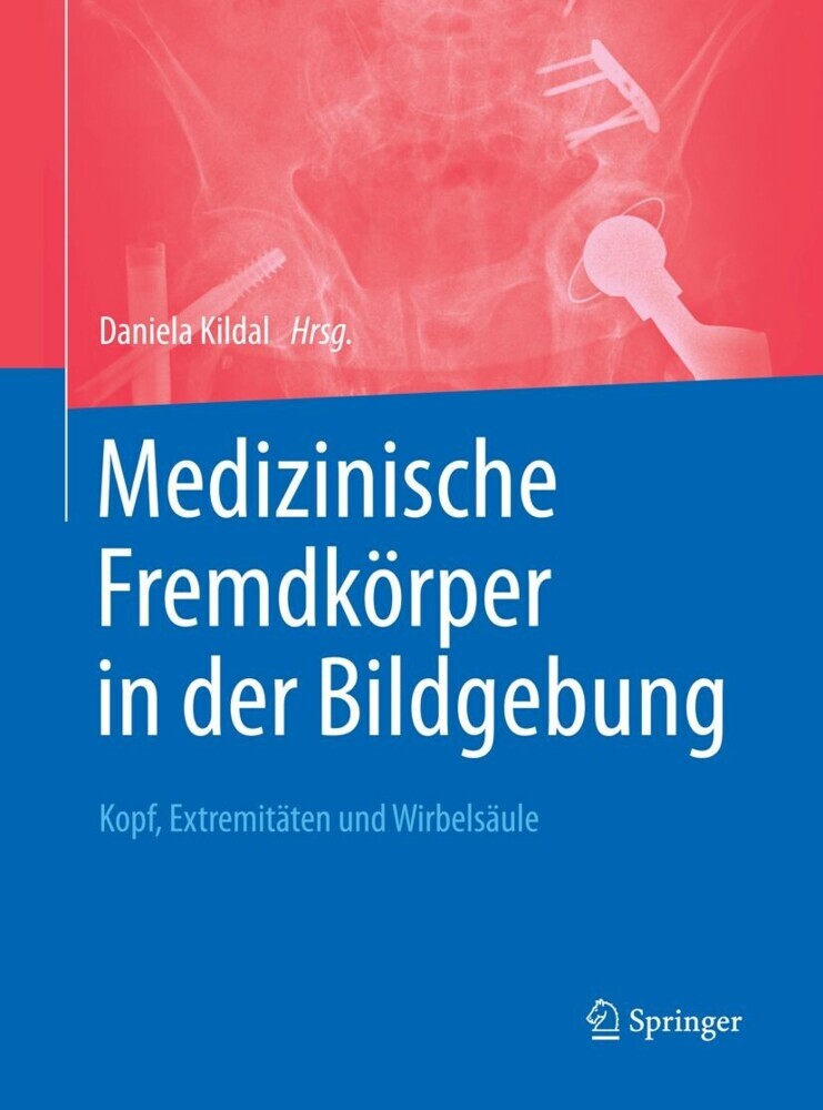 Medizinische Fremdkörper in der Bildgebung main product photo