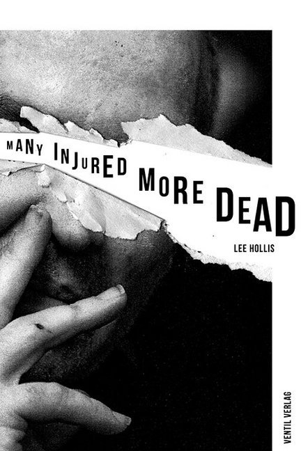 Many Injured, More Dead main product photo