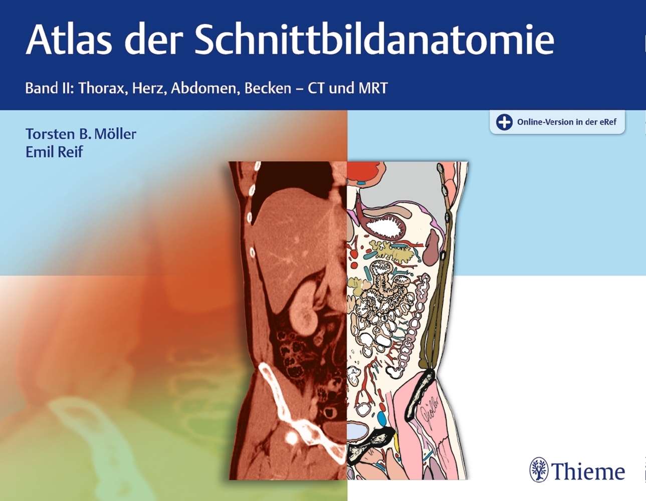 Atlas der Schnittbildanatomie. Bd.2 main product photo