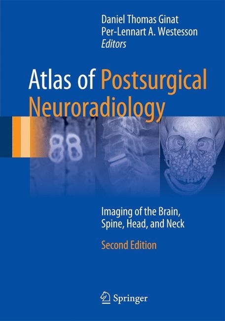 Atlas of Postsurgical Neuroradiology main product photo