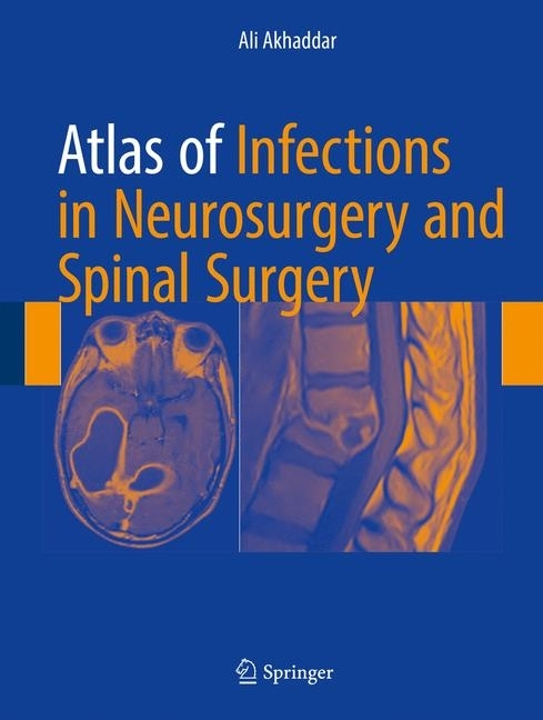 Atlas of Infections in Neurosurgery and Spinal Surgery main product photo