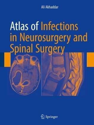 Atlas of Infections in Neurosurgery and Spinal Surgery