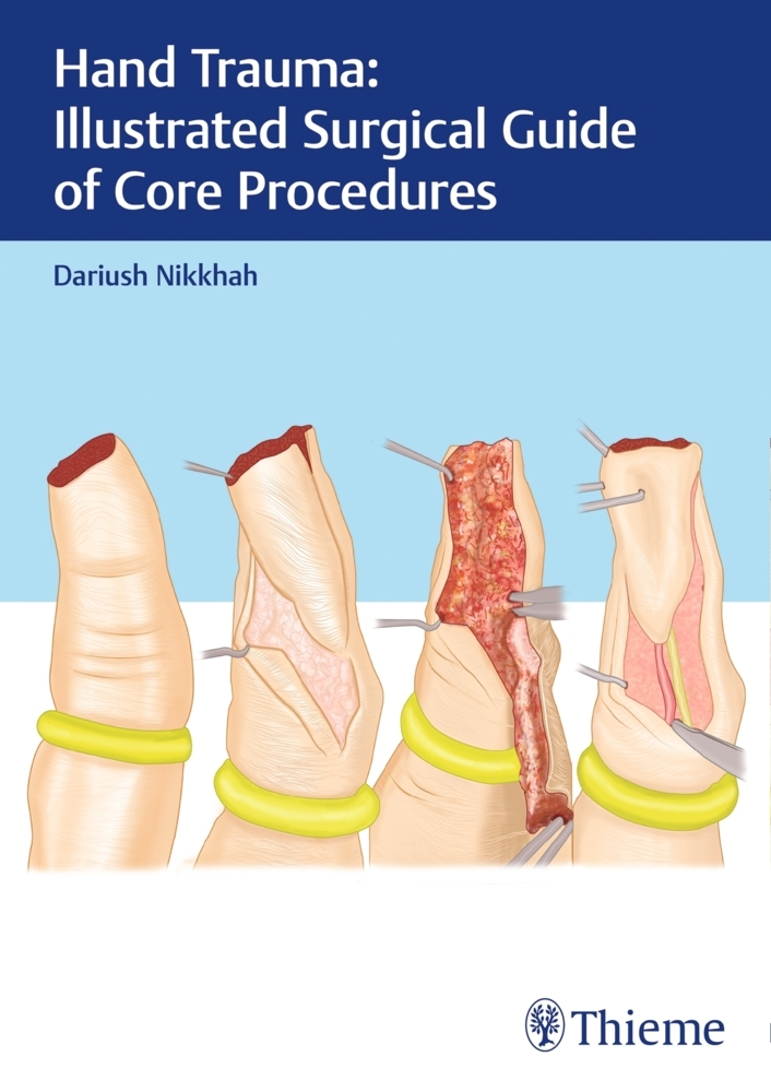 Hand Trauma: Illustrated Surgical Guide of Core Procedures main product photo
