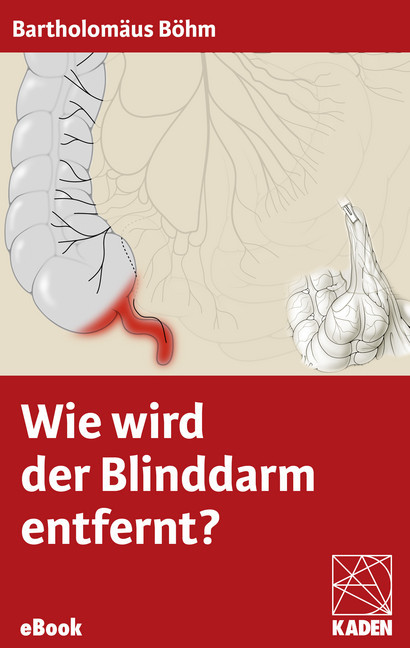 Wie wird der Blinddarm entfernt? main product photo