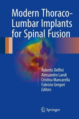 Modern Thoraco-Lumbar Implants for Spinal Fusion