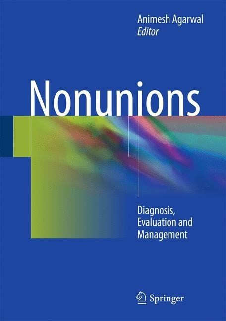 Nonunions main product photo