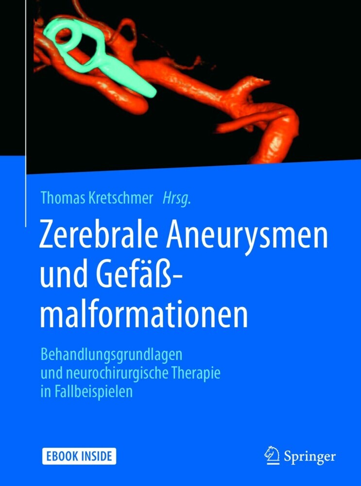 Zerebrale Aneurysmen und Gefäßmalformationen main product photo