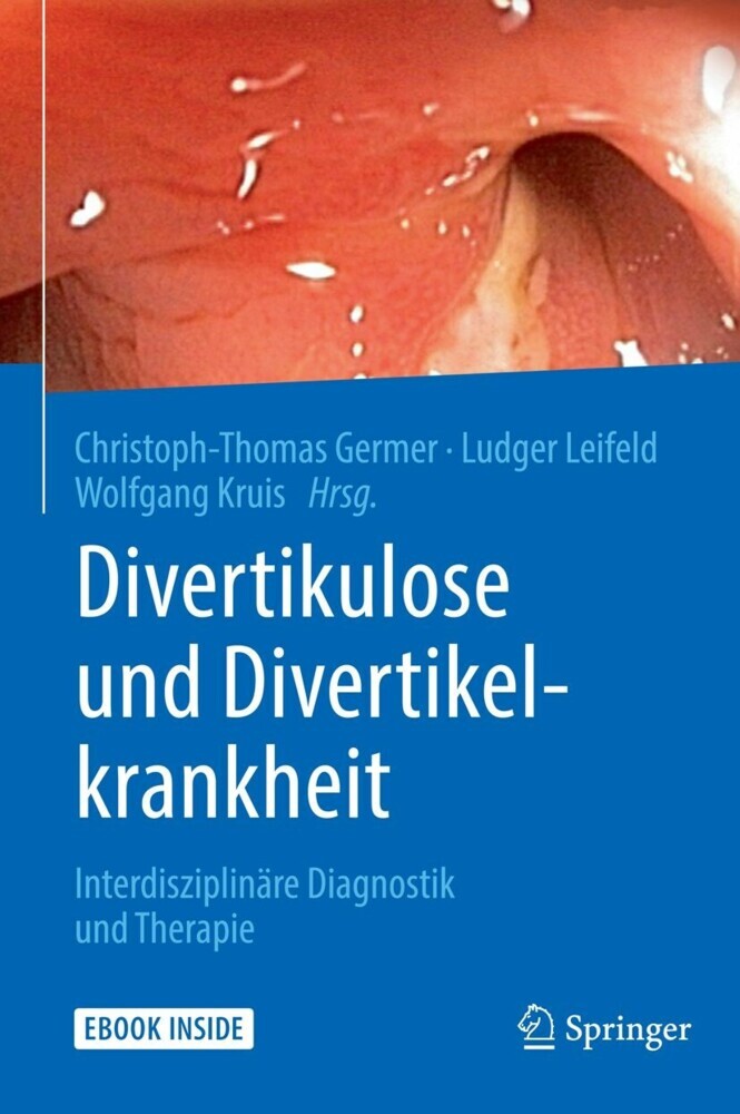 Divertikulose und Divertikelkrankheit main product photo