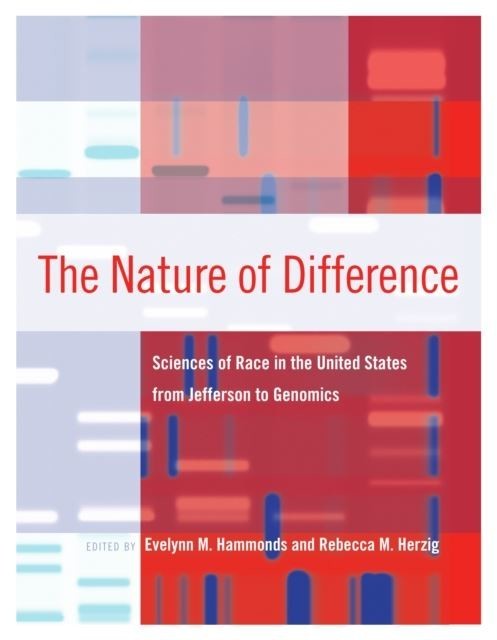 Nature of Difference main product photo