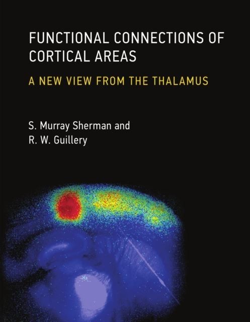 Functional Connections of Cortical Areas main product photo