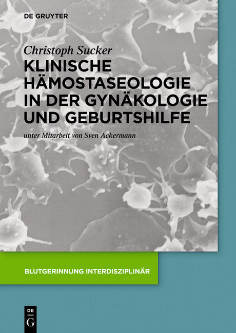 Klinische Hämostaseologie in der Gynäkologie und Geburtshilfe main product photo