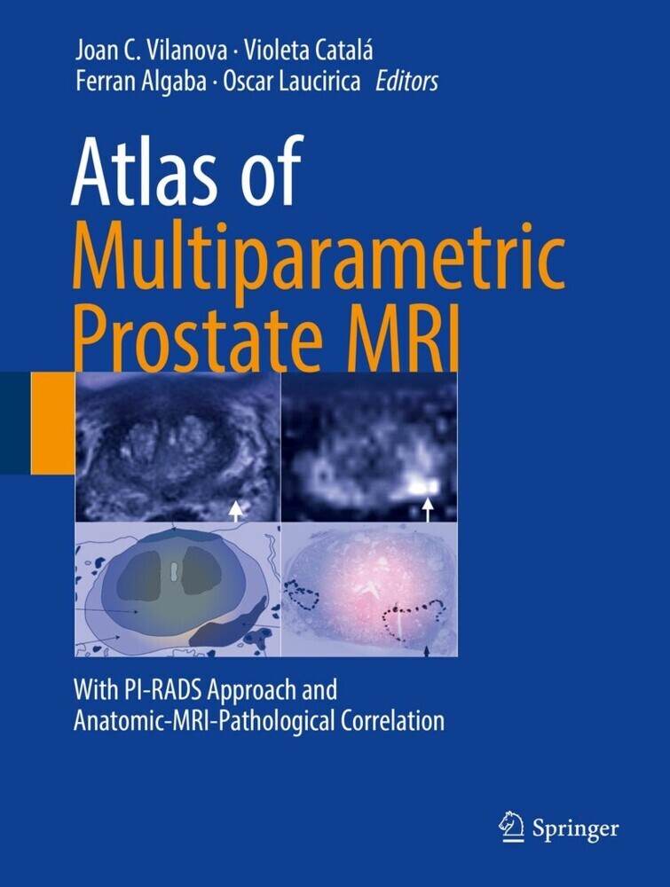 Atlas of Multiparametric Prostate MRI main product photo