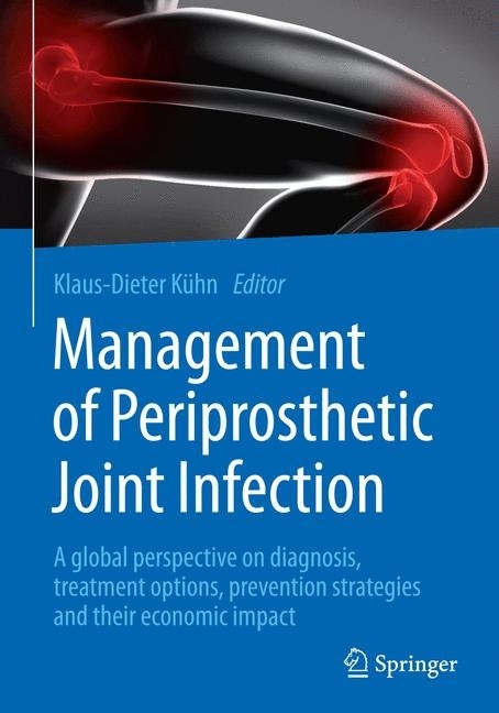 Management of Periprosthetic Joint Infection main product photo