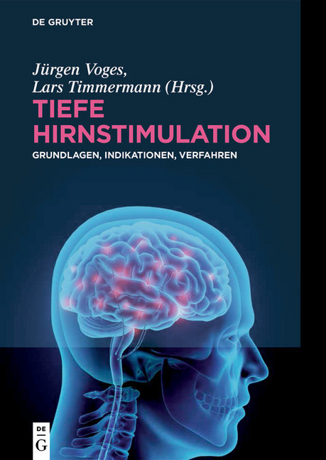 Tiefe Hirnstimulation main product photo