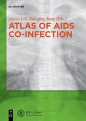 Atlas of AIDS Co-infection main product photo