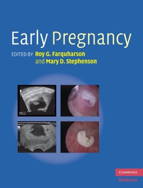 Early Pregnancy main product photo