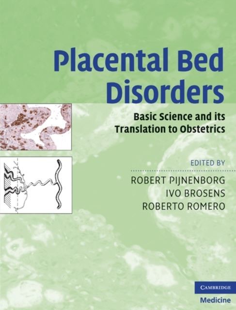 Placental Bed Disorders main product photo