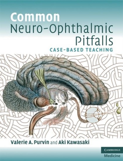 Common Neuro-Ophthalmic Pitfalls main product photo