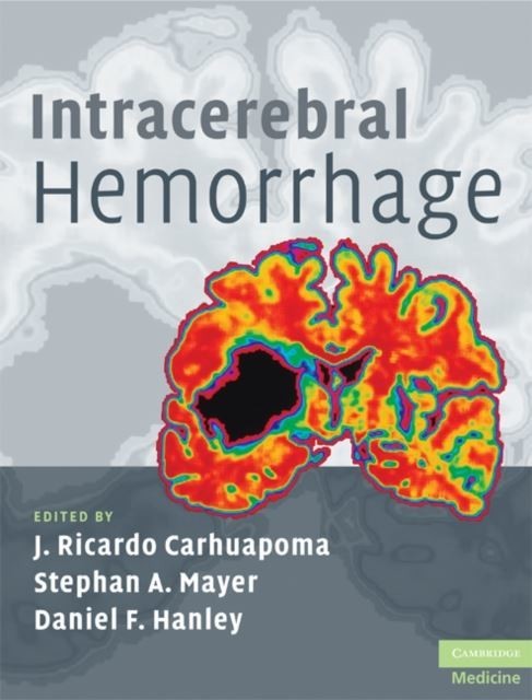 Intracerebral Hemorrhage main product photo