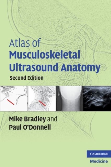 Atlas of Musculoskeletal Ultrasound Anatomy main product photo