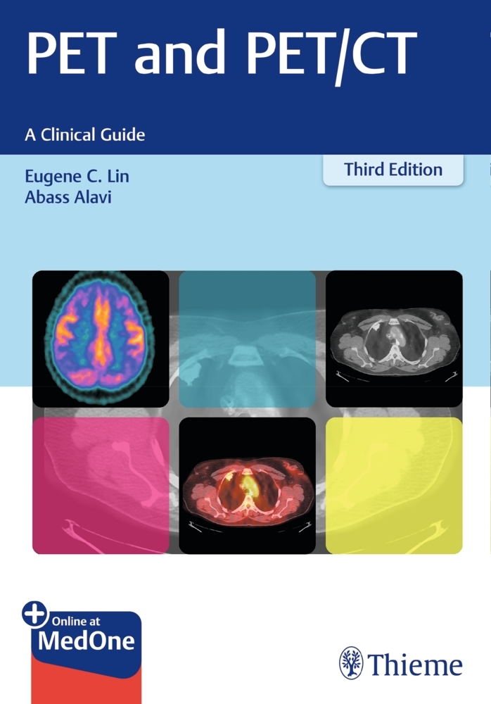 PET and PET/CT main product photo