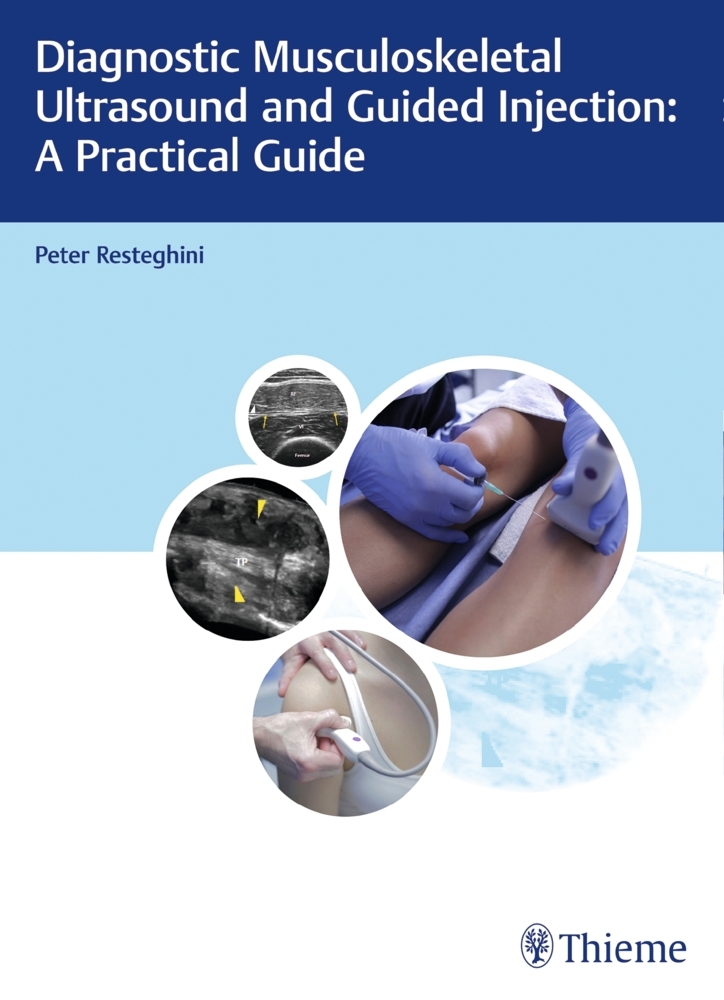 Diagnostic Musculoskeletal Ultrasound and Guided Injection: A Practical Guide; . main product photo