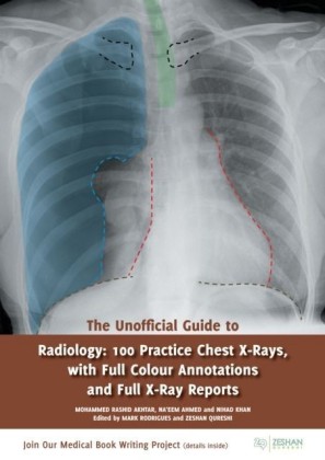 Unofficial Guide to Radiology