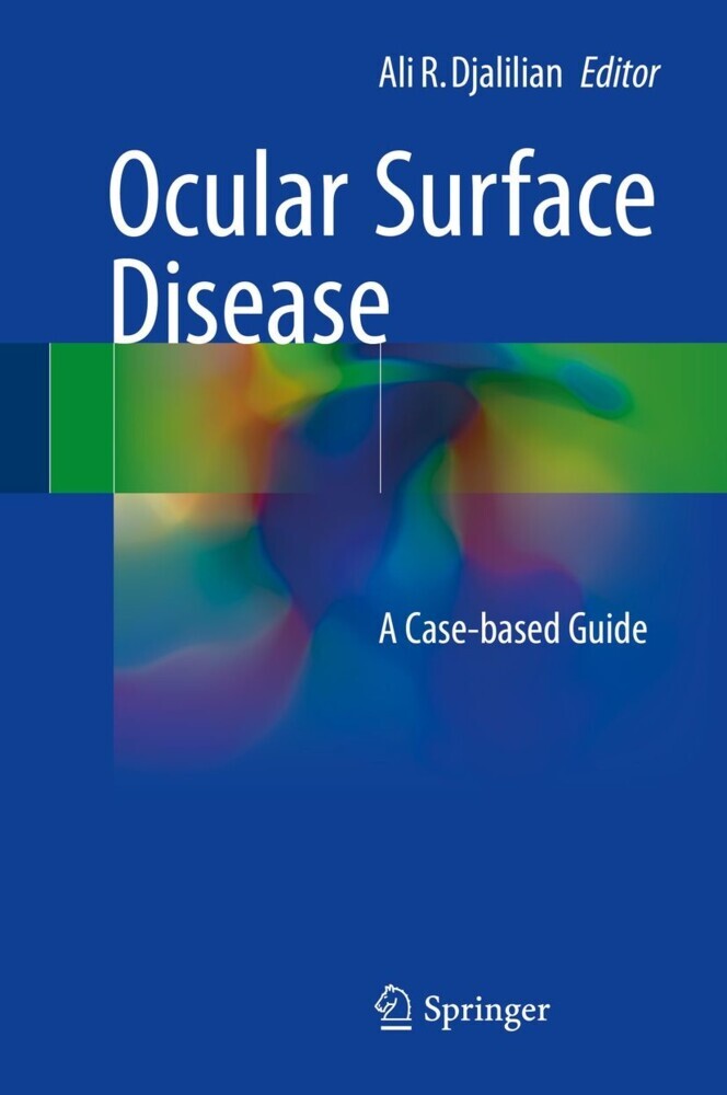 Ocular Surface Disease main product photo