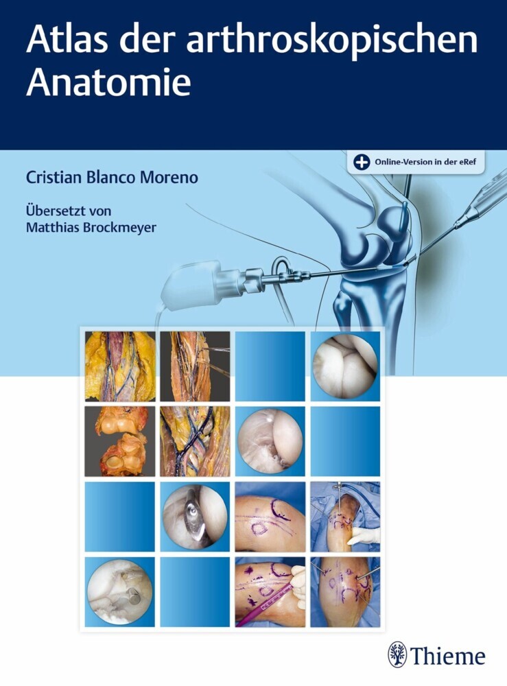 Atlas der arthroskopischen Anatomie main product photo