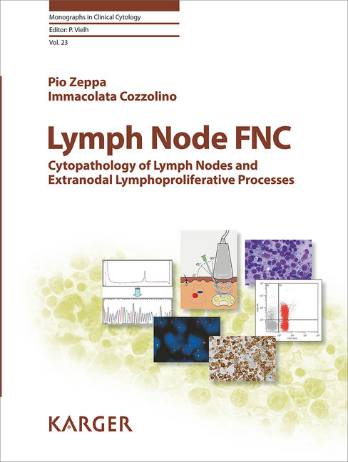 Lymph Node FNC main product photo